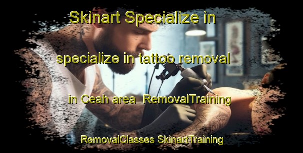 Skinart Specialize in specialize in tattoo removal in Ceah area | #RemovalTraining #RemovalClasses #SkinartTraining-Indonesia